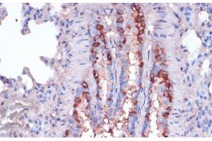 Immunohistochemistry of paraffin-embedded Rat lung using RPL22 Polyclonal Antibody at dilution of 1:100 (40x lens). (RPL22 anticorps)