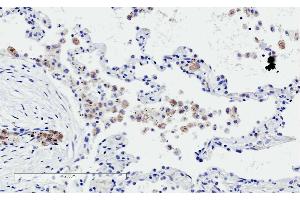 ABIN190752 (2µg/ml) staining of paraffin embedded Human Lung. (TREM2 anticorps  (C-Term))