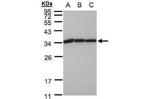 WB Image Sample(30 ug whole cell lysate) A:A431, B:H1299 C:HeLa S3, 12% SDS PAGE antibody diluted at 1:1000 (EEF1B2 anticorps)