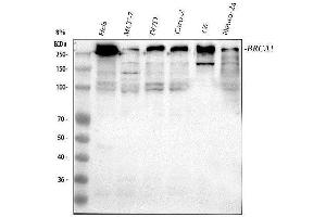 Western blot analysis of BRCA1 using anti-BRCA1 antibody (ABIN5518742).