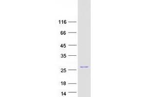 BCL2-Associated Agonist of Cell Death (BAD) (Transcript Variant 1) protein (Myc-DYKDDDDK Tag)