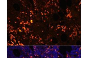 Immunofluorescence analysis of Rat bone marrow cells using GPR55 Polyclonal Antibody at dilution of 1:100. (GPR55 anticorps)