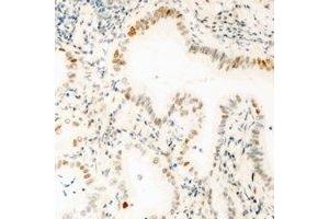 Immunohistochemical analysis of GABPB1 staining in mouse kidney formalin fixed paraffin embedded tissue section.