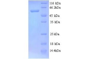SDS-PAGE (SDS) image for Cystathionine-beta-Synthase (CBS) (AA 1-507), (full length) protein (His tag) (ABIN4977081) (CBS Protein (AA 1-507, full length) (His tag))