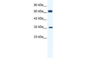 KCNN1 antibody used at 1. (KCNN1 anticorps  (C-Term))