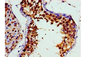Immunohistochemistry of paraffin-embedded human testis tissue using ABIN7172893 at dilution of 1:100