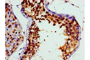 Immunohistochemistry of paraffin-embedded human testis tissue using ABIN7172893 at dilution of 1:100 (VCP anticorps  (AA 704-806))