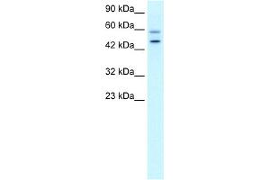 WB Suggested Anti-DKFZP761C169 Antibody Titration:  0. (GC-Rich Promoter Binding Protein 1 (GPBP1) (N-Term) anticorps)