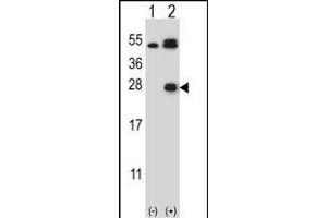 Western blot analysis of KLK6 (arrow) using rabbit polyclonal KLK6 Antibody  (ABIN652196 and ABIN2840742). (Kallikrein 6 anticorps  (AA 126-156))