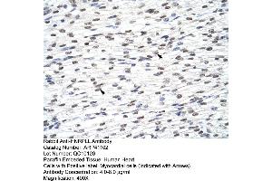 Rabbit Anti-HNRPLL Antibody  Paraffin Embedded Tissue: Human Heart Cellular Data: Myocardial cells Antibody Concentration: 4.