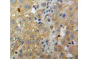 Used in DAB staining on fromalin fixed paraffin-embedded Liver tissue (CXCL2 anticorps  (AA 28-100))