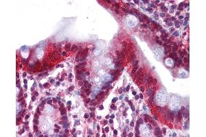 Immunohistochemistry (IHC) image for anti-Hepatocyte Nuclear Factor 4, alpha (HNF4A) (Middle Region) antibody (ABIN2779763)