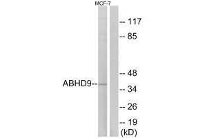 Western blot analysis of extracts from MCF-7 cells, using ABHD9 antibody. (ABHD9 anticorps)