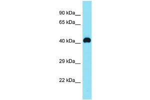 Host: Rabbit Target Name: C8orf76 Sample Type: MDA-MB-435S Whole Cell lysates Antibody Dilution: 1. (C8orf76 anticorps  (N-Term))