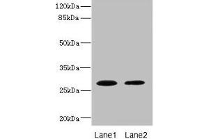 Western blot All lanes: TPK1 antibody at 0. (TPK1 anticorps  (AA 1-243))
