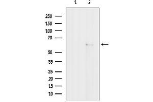 Western blot analysis of lysates from Colo205, using NRBP1 Antibody.