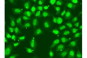 Immunofluorescence analysis of A549 cell using FANCD2 antibody. (FANCD2 anticorps)