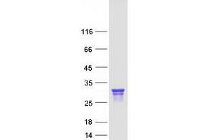 Validation with Western Blot