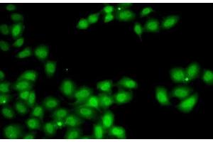 Immunofluorescence analysis of A-549 cells using GGH Polyclonal Antibody (GGH anticorps)