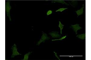Immunofluorescence of monoclonal antibody to HHEX on HeLa cell.