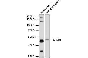Western blot analysis of extracts of various cell lines, using  antibody (ABIN7265502) at 1:1000 dilution. (ADRB1 anticorps  (AA 150-250))
