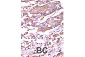 Immunohistochemistry (IHC) image for anti-Calcium/calmodulin-Dependent Protein Kinase II alpha (CAMK2A) antibody (ABIN3003046) (CAMK2A anticorps)
