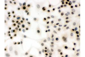 IHC analysis of p95 NBS1 using anti-p95 NBS1 antibody .