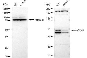 Western blotting analysis using AP2M1 antibody (ABIN7797509). (Recombinant AP2M1 anticorps)