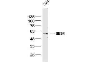 TM4 Mouse Cell lysates probed with BBS4 Polyclonal Antibody, unconjugated  at 1:300 overnight at 4°C followed by a conjugated secondary antibody for 60 minutes at 37°C. (BBS4 anticorps  (AA 431-519))