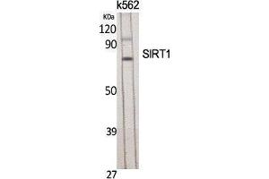 Western Blotting (WB) image for anti-Sirtuin 1 (SIRT1) (Tyr631) antibody (ABIN3177418) (SIRT1 anticorps  (Tyr631))