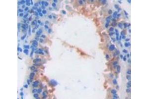 IHC-P analysis of Mouse Tissue, with DAB staining. (ARPC4 anticorps  (AA 79-164))