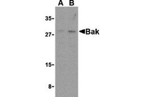 Western Blotting (WB) image for anti-BCL2-Antagonist/killer 1 (BAK1) (N-Term) antibody (ABIN1031258) (BAK1 anticorps  (N-Term))