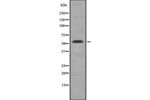 Western blot analysis of CYP3A5 using HepG2 whole cell lysates (CYP3A5 anticorps)