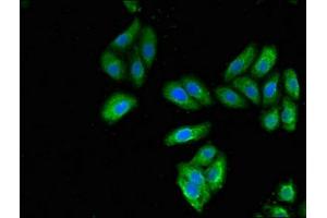 Immunofluorescent analysis of HepG2 cells using ABIN7157444 at dilution of 1:100 and Alexa Fluor 488-congugated AffiniPure Goat Anti-Rabbit IgG(H+L)