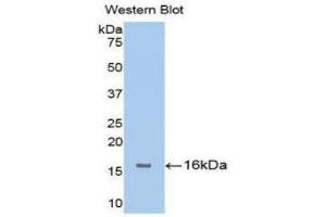 Western Blotting (WB) image for anti-Fibroblast Growth Factor Receptor 1 (FGFR1) (AA 236-362) antibody (ABIN3201622) (FGFR1 anticorps  (AA 236-362))