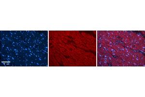 Rabbit Anti-SLC25A12 Antibody    Formalin Fixed Paraffin Embedded Tissue: Human Adult heart  Observed Staining: Cytoplasmic Primary Antibody Concentration: 1:100 Secondary Antibody: Donkey anti-Rabbit-Cy2/3 Secondary Antibody Concentration: 1:200 Magnification: 20X Exposure Time: 0.
