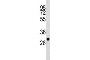 SDHB antibody western blot analysis in 293 lysate