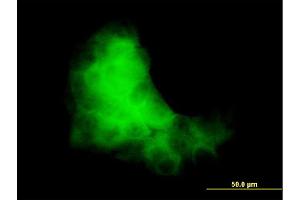 Immunofluorescence of monoclonal antibody to S100A7 on A-431 cell.