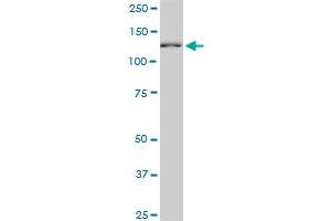 CAND1 monoclonal antibody (M03), clone 2D7. (CAND1 anticorps  (AA 1-100))