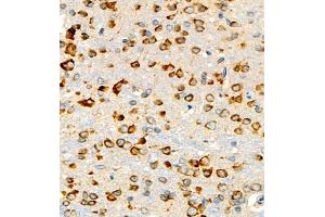 Immunohistochemistry of paraffin embedded mouse brain using P4H (ABIN7074215) at dilution of 1:700 (400x lens) (HIF Prolyl Hydroxylase anticorps)