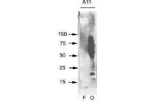 Aβ42 fibrils (F) and prefibrillar oligomers (O) were run on SDS polyacrylamide gels, transferred to nitrocellulose and probed with this antibody (A11). (Amyloid Oligomers anticorps)