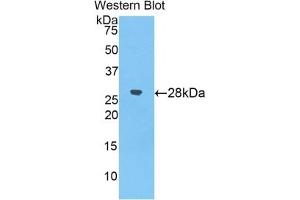 WB of Protein Standard: different control antibodies against Highly purified E.