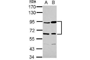WB Image Sample (30 ug of whole cell lysate) A: Raji B: K562 7. (Complement Factor B anticorps)