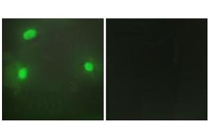 Immunofluorescence analysis of HeLa cells, using FEN1 antibody. (FEN1 anticorps  (Internal Region))