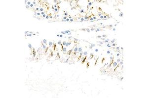 Immunohistochemistry analysis of paraffin-embedded rat testis using,Arp2 (ABIN7072895) at dilution of 1: 800