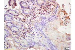 anti-Tripartite Motif Containing 21 (TRIM21) (AA 301-400) antibody