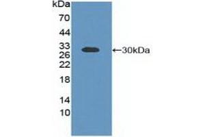 Detection of Recombinant Bcl2L, Human using Polyclonal Antibody to B-Cell CLL/Lymphoma 2 Like Protein (Bcl2L) (BCL2L1 anticorps  (AA 2-212))