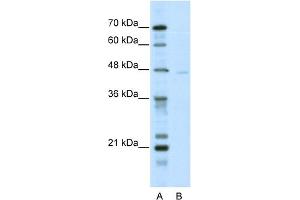 WB Suggested Anti-TRIM38 Antibody Titration:  5. (TRIM38 anticorps  (N-Term))