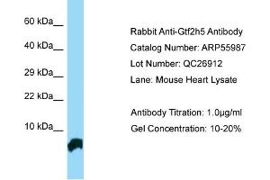 Western Blotting (WB) image for anti-General Transcription Factor IIH, Polypeptide 5 (GTF2H5) (N-Term) antibody (ABIN970845) (GTF2H5 anticorps  (N-Term))
