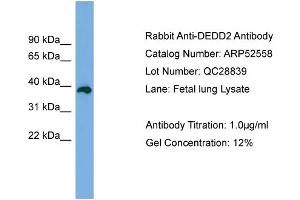 WB Suggested Anti-DEDD2  Antibody Titration: 0. (DEDD2 anticorps  (Middle Region))